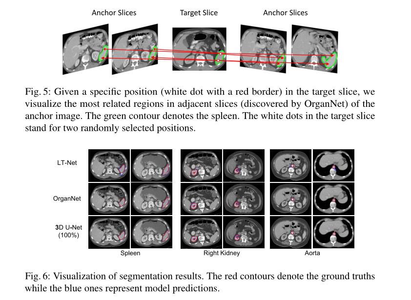 [小样本医学图像]Generalized Organ Segmentation by Imitating One-shot Reasoning using Anatomical Correlation - 文章图片